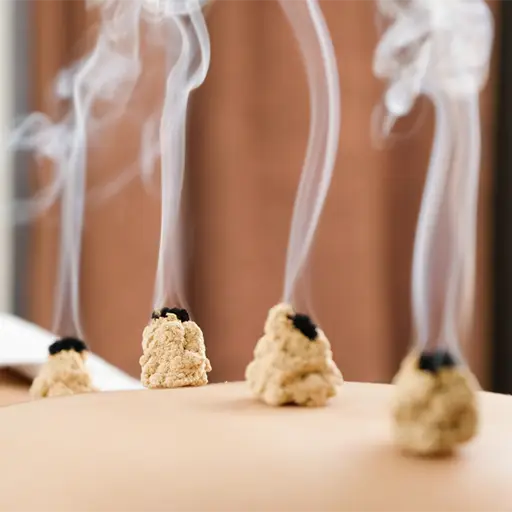 Moxibustion 2 Moxibustion